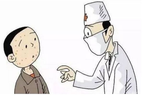 天花是怎么造成的呢 造成天花的原因有什么呢 天花是怎么造成的呢 造成天花的原因有什么呢