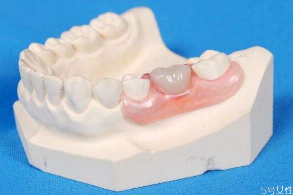 牙縫變大是怎么造成的呢 牙縫變大有什么危害呢 牙縫變大是怎么造成的呢 牙縫變大有什么危害呢