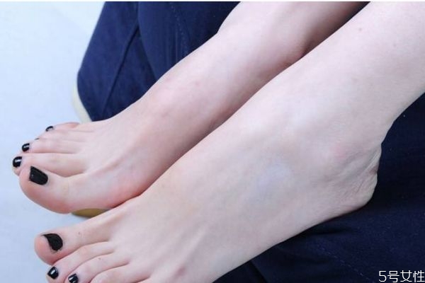 為什么女生腳會(huì)非常大呢 造成女生腳大的原因有什么呢 為什么女生腳會(huì)非常大呢 造成女生腳大的原因有什么呢