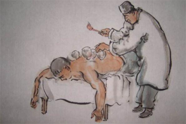 拔罐減肥什么時(shí)間最好 拔罐減肥什么季節(jié)最好 拔罐減肥什么時(shí)間最好 拔罐減肥什么季節(jié)最好