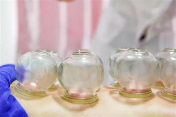 拔罐減肥會反彈嗎 拔罐減肥有壞處嗎 拔罐減肥會反彈嗎 拔罐減肥有壞處嗎