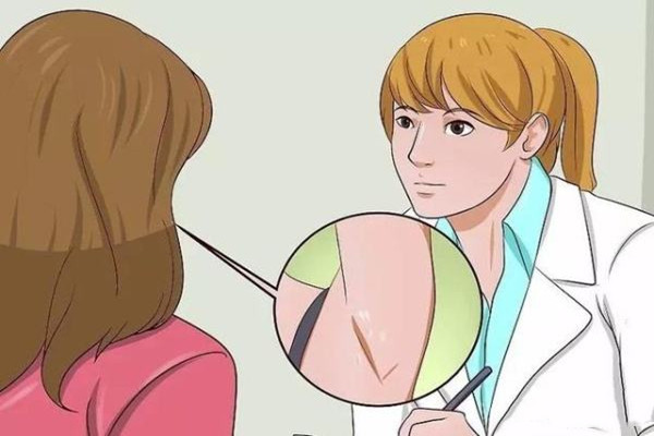 狐臭的表現(xiàn)有哪些 如何預(yù)防狐臭的發(fā)生 狐臭的表現(xiàn)有哪些 如何預(yù)防狐臭的發(fā)生