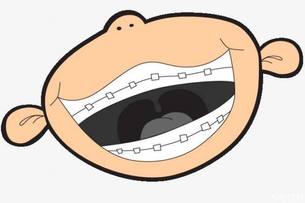 美容冠矯正有什么作用 美容冠矯正多少錢 美容冠矯正有什么作用 美容冠矯正多少錢