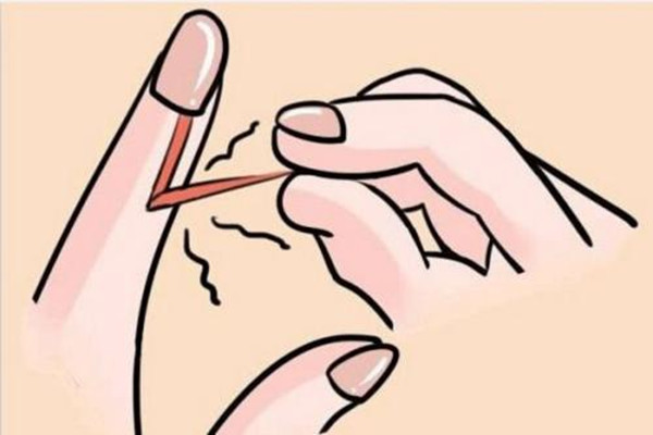 拔倒刺手腫了怎么辦 倒刺怎么處理不會(huì)腫 拔倒刺手腫了怎么辦 倒刺怎么處理不會(huì)腫