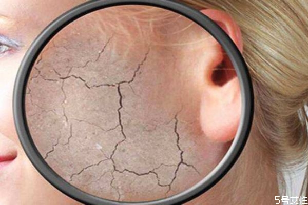 皮膚干燥起皮吃點(diǎn)什么最好 皮膚干燥起皮怎么辦 皮膚干燥起皮吃點(diǎn)什么最好 皮膚干燥起皮怎么辦