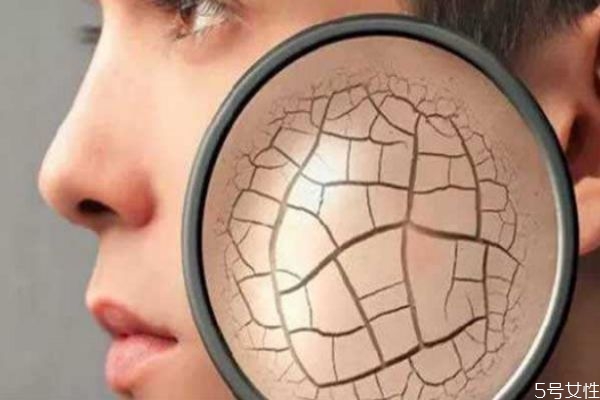 皮膚干燥起皮吃點(diǎn)什么最好 皮膚干燥起皮怎么辦 皮膚干燥起皮吃點(diǎn)什么最好 皮膚干燥起皮怎么辦