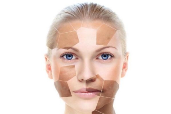 什么是化妝品皮炎 化妝品皮炎的癥狀 什么是化妝品皮炎 化妝品皮炎的癥狀