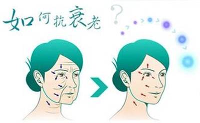 面部肌肉松弛下垂的原因 面部肌肉松弛下垂怎么辦 面部肌肉松弛下垂的原因 面部肌肉松弛下垂怎么辦