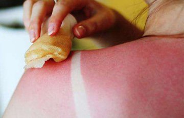 嚴(yán)重曬脫皮怎么護理 曬脫皮一周能好嗎 嚴(yán)重曬脫皮怎么護理 曬脫皮一周能好嗎