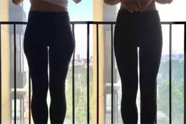 假胯寬是什么樣的 假胯寬能減掉嗎 假胯寬是什么樣的 假胯寬能減掉嗎