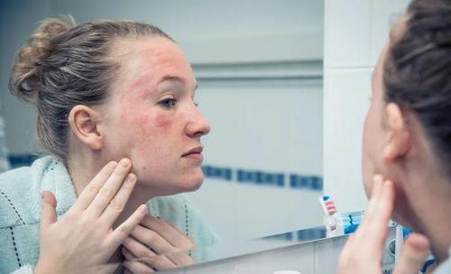 敏感肌用化妝品怎么樣做過敏試驗 如何減少化妝對皮膚的傷害 敏感肌用化妝品怎么樣做過敏試驗 如何減少化妝對皮膚的傷害