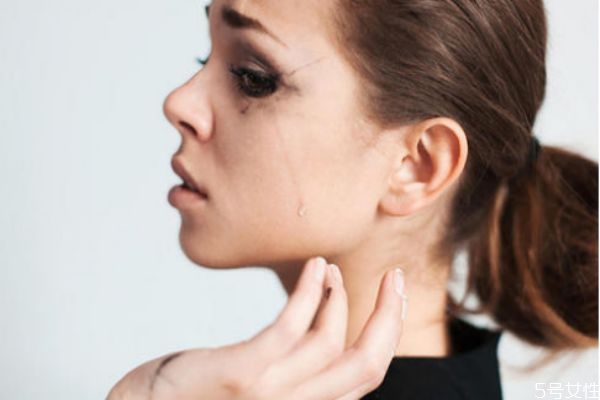 如何收縮鼻翼 收縮鼻翼的辦法 如何收縮鼻翼 收縮鼻翼的辦法