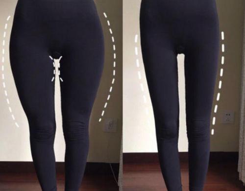 假胯寬和真胯寬怎么辨別 假胯寬是怎樣形成的 假胯寬和真胯寬怎么辨別 假胯寬是怎樣形成的