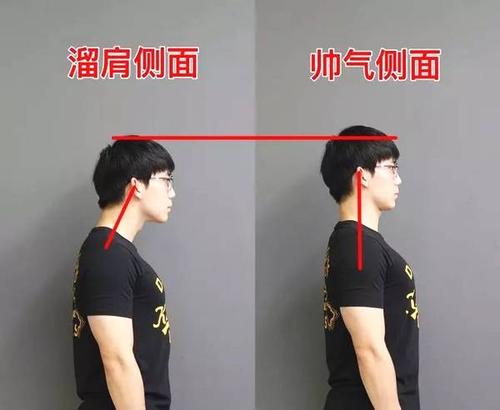 溜肩為什么叫美人尖 溜肩是先天的嗎 溜肩為什么叫美人尖 溜肩是先天的嗎