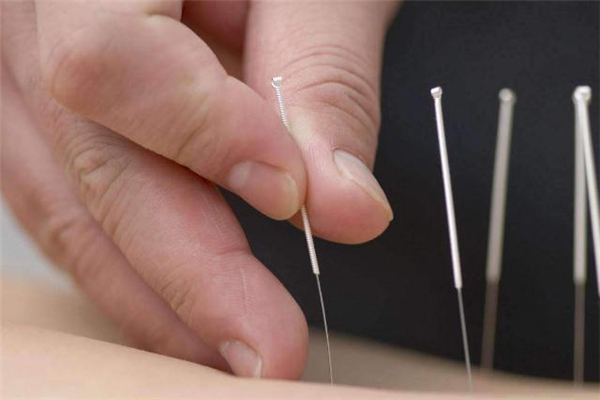 針灸減肥后可以吃飯嗎 針灸減肥后能吃東西嗎 針灸減肥后可以吃飯嗎 針灸減肥后能吃東西嗎