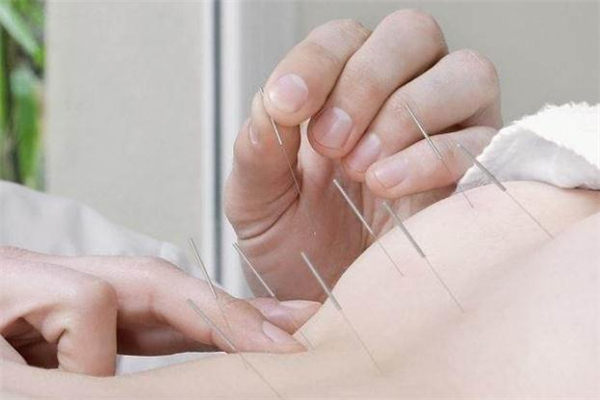 針灸減肥后可以吃飯嗎 針灸減肥后能吃東西嗎 針灸減肥后可以吃飯嗎 針灸減肥后能吃東西嗎