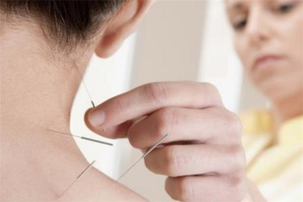 針灸減肥疼嗎 針灸減肥每天都要扎嗎 針灸減肥疼嗎 針灸減肥每天都要扎嗎