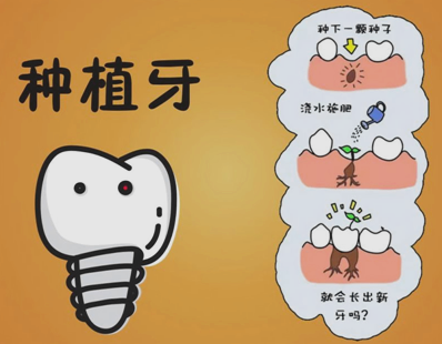 種植牙齒的壽命有多長 種植牙齒多久能恢復(fù) 種植牙齒的壽命有多長 種植牙齒多久能恢復(fù)