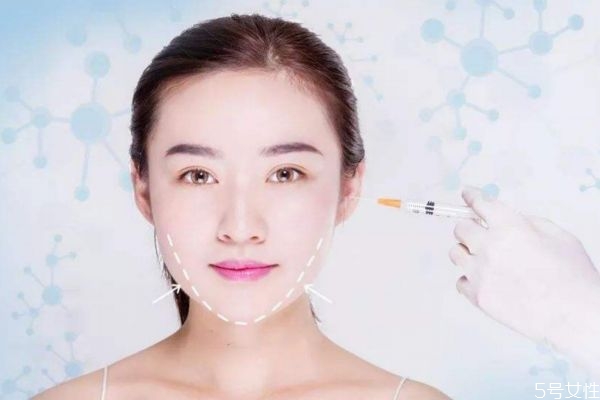 雙下巴打瘦臉針有用嗎 打瘦臉針可以瘦雙下巴嗎 雙下巴打瘦臉針有用嗎 打瘦臉針可以瘦雙下巴嗎