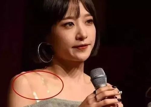 怎么方式透明肩帶變黃 防止透明肩帶變黃的方法 怎么方式透明肩帶變黃 防止透明肩帶變黃的方法