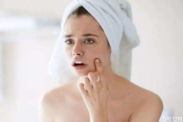 臉上長細(xì)紋了怎么辦 臉上有細(xì)紋有小妙招 臉上長細(xì)紋了怎么辦 臉上有細(xì)紋有小妙招