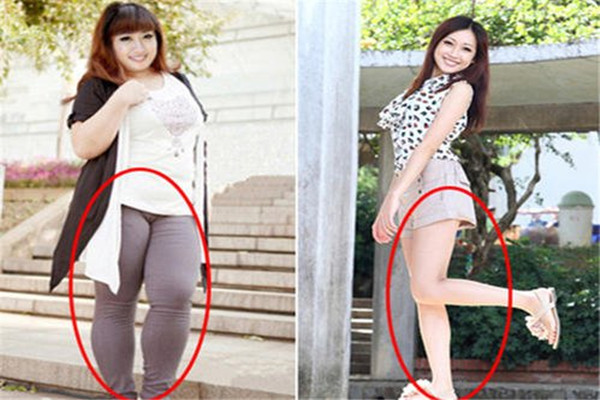 哪些壞習慣會導致大象腿 導致大象腿的原因 哪些壞習慣會導致大象腿 導致大象腿的原因