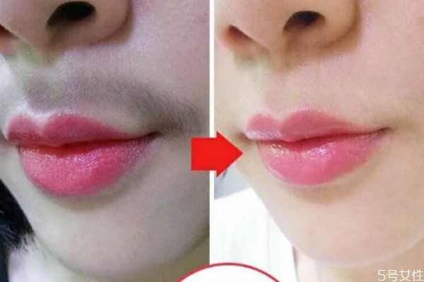 女性造成唇毛的原因是什么 為什么女性會(huì)長唇毛 女性造成唇毛的原因是什么 為什么女性會(huì)長唇毛
