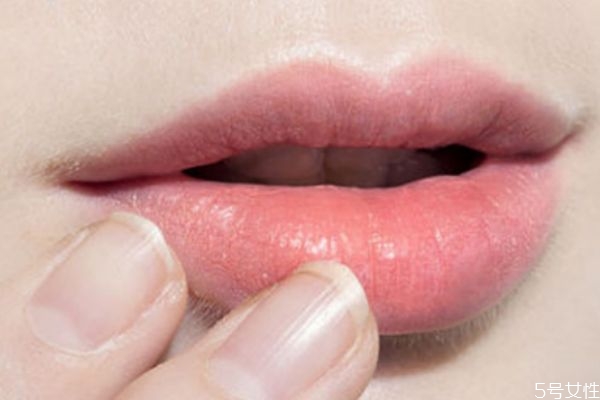 嘴唇顏色太暗是怎么回事 嘴唇顏色暗怎么調(diào)理 嘴唇顏色太暗是怎么回事 嘴唇顏色暗怎么調(diào)理