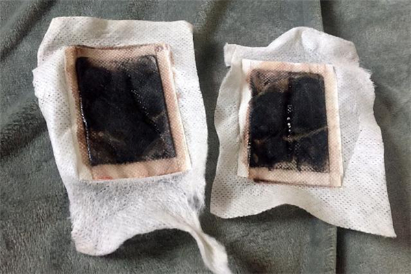 貼足貼腳底為什么出油 足貼排出來的油是什么 貼足貼腳底為什么出油 足貼排出來的油是什么