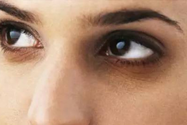 怎么辨別干紋和細(xì)紋 干紋和細(xì)紋有什么不一樣 怎么辨別干紋和細(xì)紋 干紋和細(xì)紋有什么不一樣