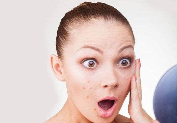 日常擠痘痘要注意什么 有關擠痘痘的小知識推薦