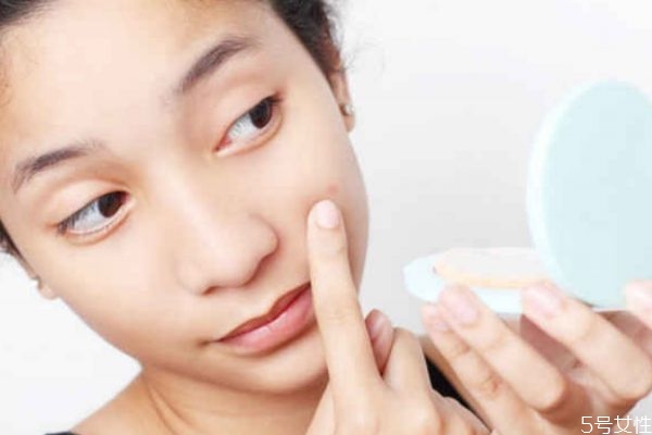 為什么不可以用手擠痘痘 不能用手擠痘痘的原因 為什么不可以用手擠痘痘 不能用手擠痘痘的原因