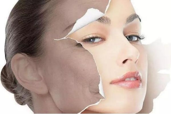 臉上的痘印怎么恢復(fù) 臉上留了痘印怎么辦 臉上的痘印怎么恢復(fù) 臉上留了痘印怎么辦