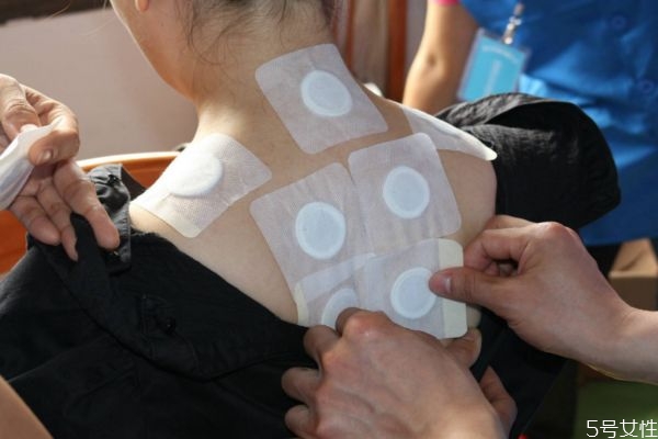 三伏貼什么時候貼最好 什么時候最適合貼三伏貼 三伏貼什么時候貼最好 什么時候最適合貼三伏貼