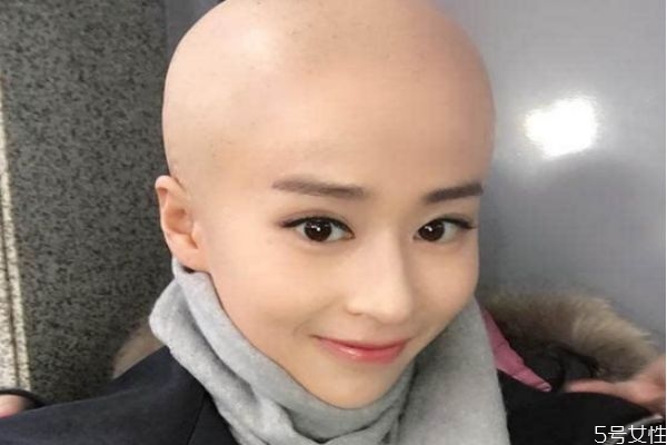 剃光頭之后頭發(fā)會變多嗎 頭發(fā)剃光再長會變多嗎 剃光頭之后頭發(fā)會變多嗎 頭發(fā)剃光再長會變多嗎