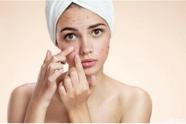 臉上有痘坑怎么辦 臉上痘坑怎么消除 臉上有痘坑怎么辦 臉上痘坑怎么消除