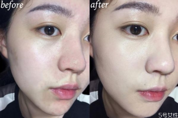 鼻子卡粉什么原因 鼻子周圍卡粉怎么回事 鼻子卡粉什么原因 鼻子周圍卡粉怎么回事