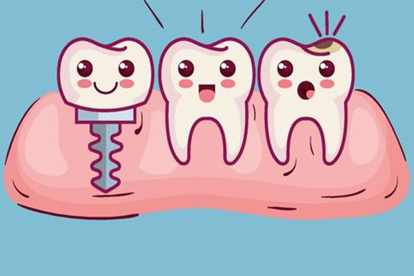 種植牙齒的好處 種植牙齒的優(yōu)點 種植牙齒的好處 種植牙齒的優(yōu)點