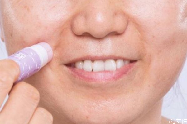 怎么去除嘴角皺紋 去除嘴角皺紋的方法 怎么去除嘴角皺紋 去除嘴角皺紋的方法