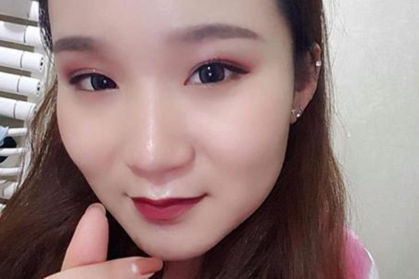 壓雙眼皮價格受什么影響 壓雙眼皮術后要注意什么 壓雙眼皮價格受什么影響 壓雙眼皮術后要注意什么