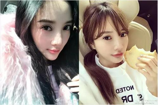 壓雙眼皮價格受什么影響 壓雙眼皮術后要注意什么 壓雙眼皮價格受什么影響 壓雙眼皮術后要注意什么