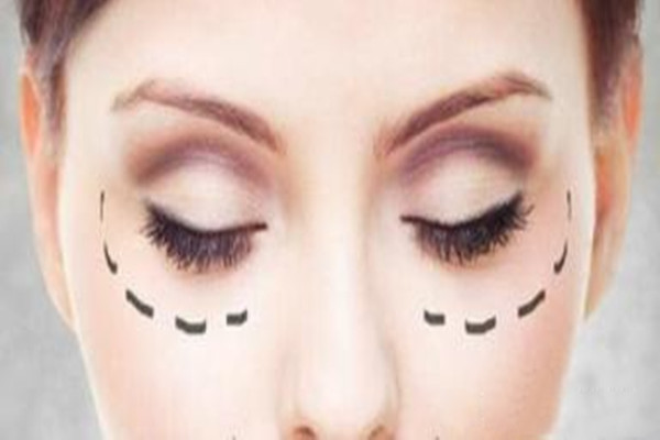 眼袋的壞處 超聲波去眼袋會打麻藥嗎 眼袋的壞處 超聲波去眼袋會打麻藥嗎