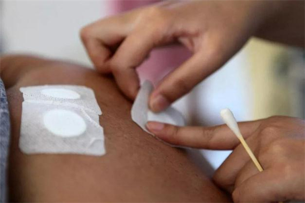 三伏貼安全嗎 三伏貼為什么不能貼的時間太長 三伏貼安全嗎 三伏貼為什么不能貼的時間太長