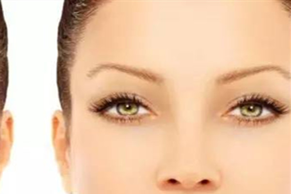 韓式去眼袋有痛感嗎 韓式去眼袋會(huì)打麻藥嗎 韓式去眼袋有痛感嗎 韓式去眼袋會(huì)打麻藥嗎