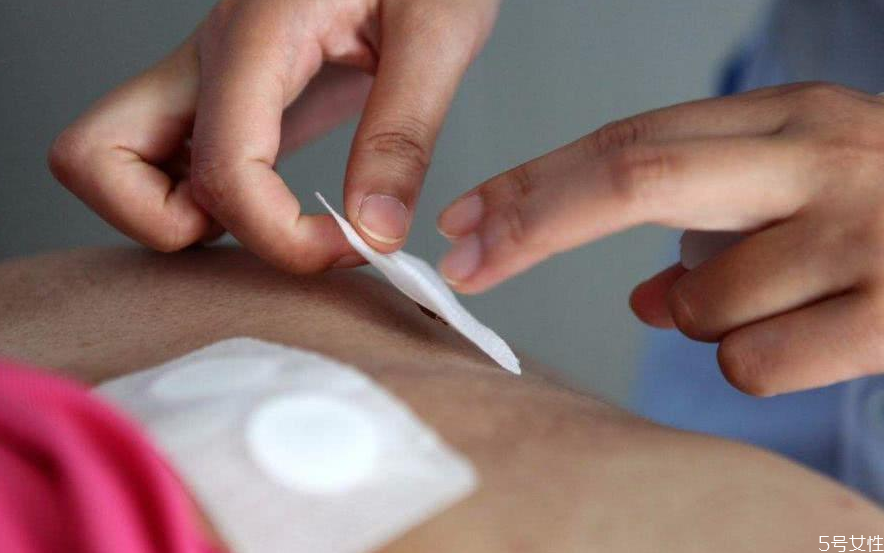 貼三伏貼放屁是怎么回事 白天貼了三伏貼晚上可以洗澡嗎 貼三伏貼放屁是怎么回事 白天貼了三伏貼晚上可以洗澡嗎