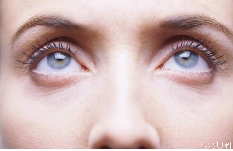 割眼袋大概多久能好 割眼袋手術(shù)會(huì)留疤嗎 割眼袋大概多久能好 割眼袋手術(shù)會(huì)留疤嗎