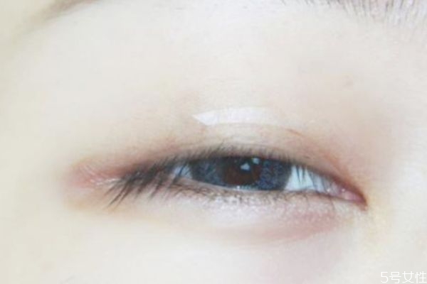 三眼皮怎樣貼雙眼皮貼 多層眼皮怎么貼雙眼皮貼 三眼皮怎樣貼雙眼皮貼 多層眼皮怎么貼雙眼皮貼