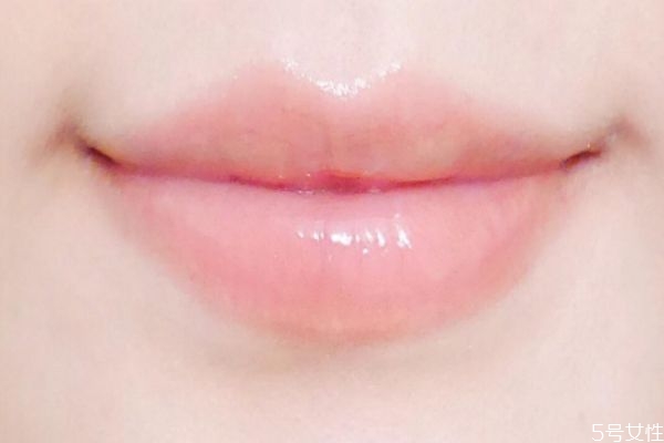 嘴巴起皮怎么辦 如何去除唇部的死皮 嘴巴起皮怎么辦 如何去除唇部的死皮