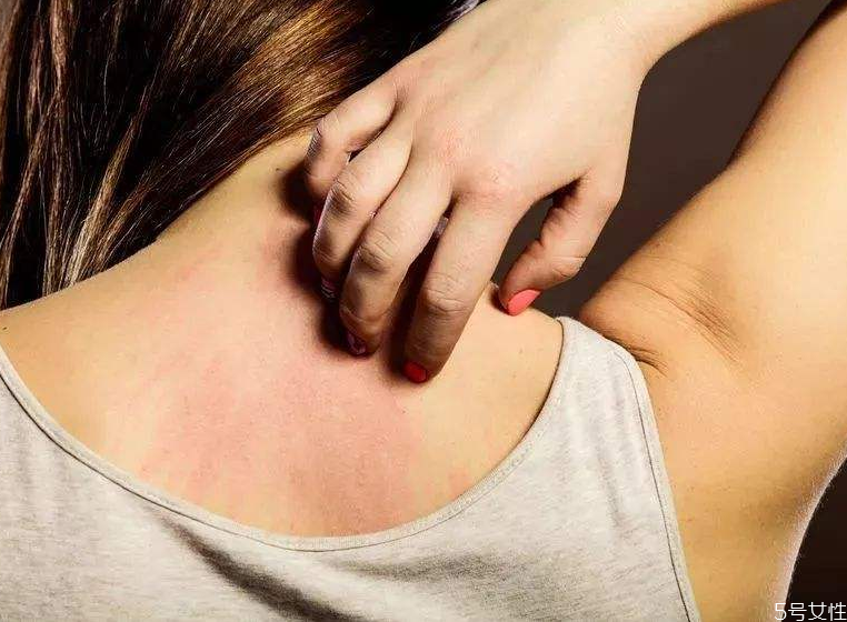 睡覺身上癢是螨蟲嗎 床上除螨蟲的最快方法 睡覺身上癢是螨蟲嗎 床上除螨蟲的最快方法