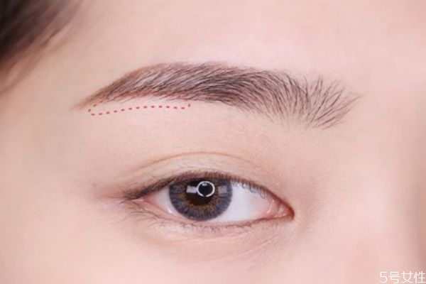 眉筆過(guò)敏怎么辦 眉筆過(guò)敏的癥狀 眉筆過(guò)敏怎么辦 眉筆過(guò)敏的癥狀